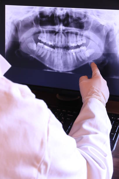 Best Emergency Root Canal Treatment in Lake Camelot, WI